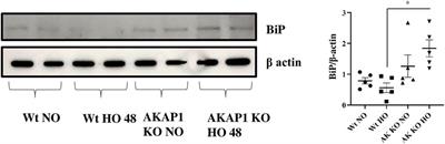 Mitochondrial Protein Akap1 Deletion Exacerbates Endoplasmic Reticulum Stress in Mice Exposed to Hyperoxia